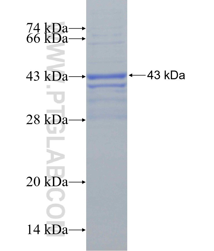 TIMP1 fusion protein Ag25386 SDS-PAGE