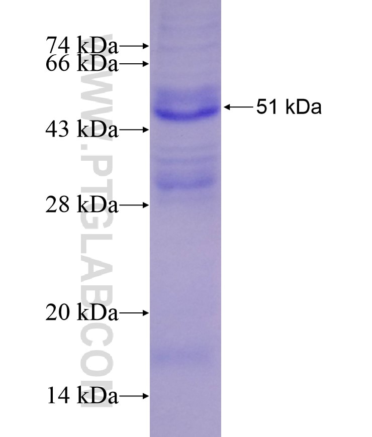 TIMP1 fusion protein Ag10006 SDS-PAGE