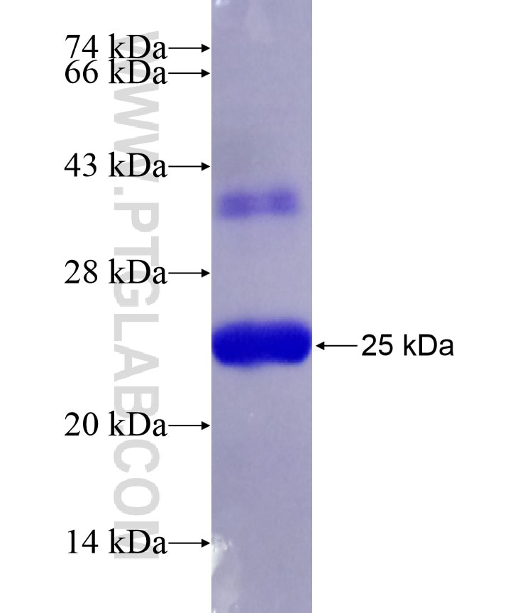 TIMP1 fusion protein Ag18348 SDS-PAGE