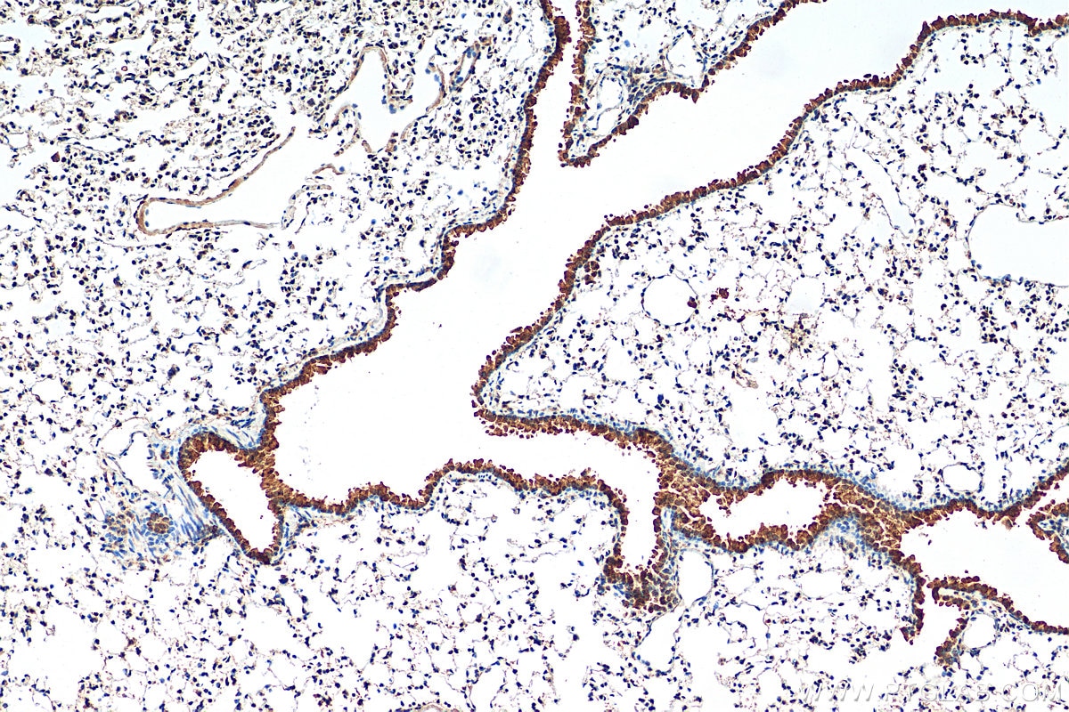 Immunohistochemistry (IHC) staining of mouse lung tissue using TIMP-2 Polyclonal antibody (17353-1-AP)
