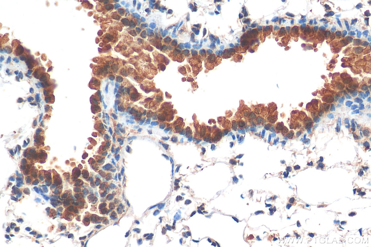 Immunohistochemistry (IHC) staining of mouse lung tissue using TIMP-2 Polyclonal antibody (17353-1-AP)