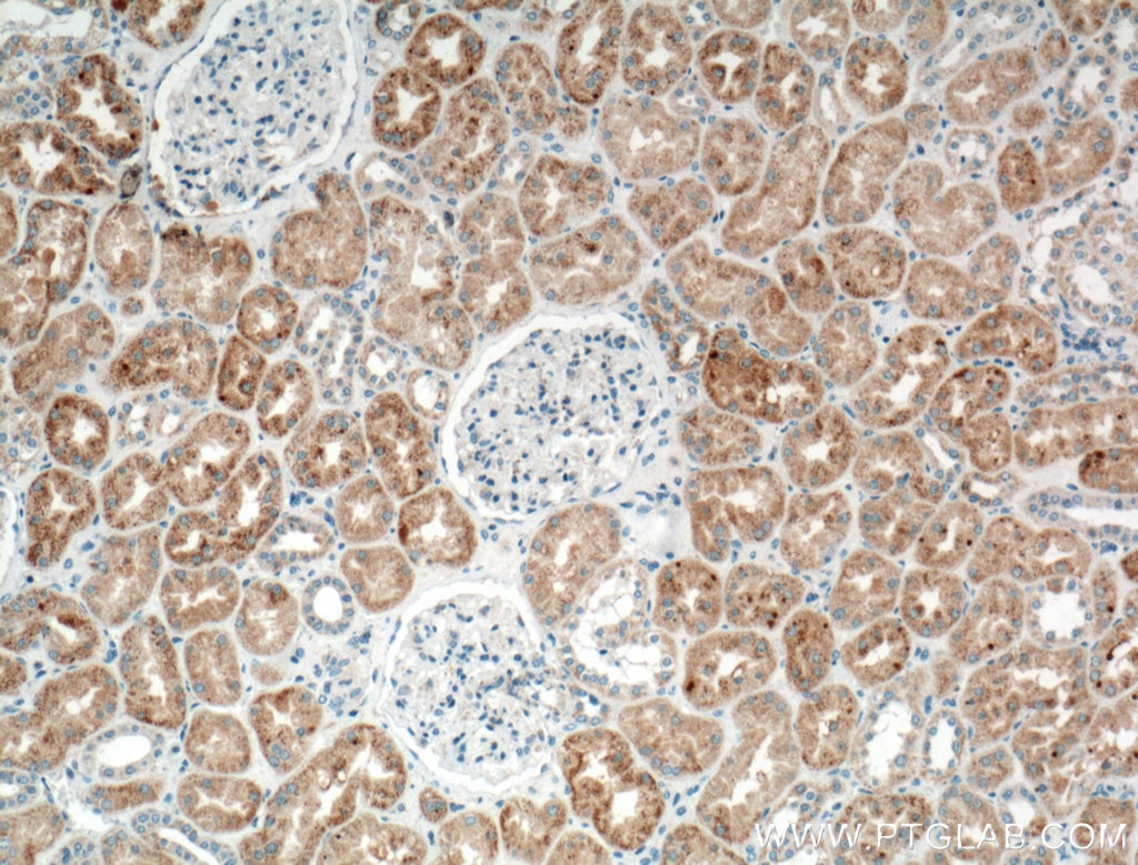 Immunohistochemistry (IHC) staining of human kidney tissue using TIMP-2 Polyclonal antibody (17353-1-AP)