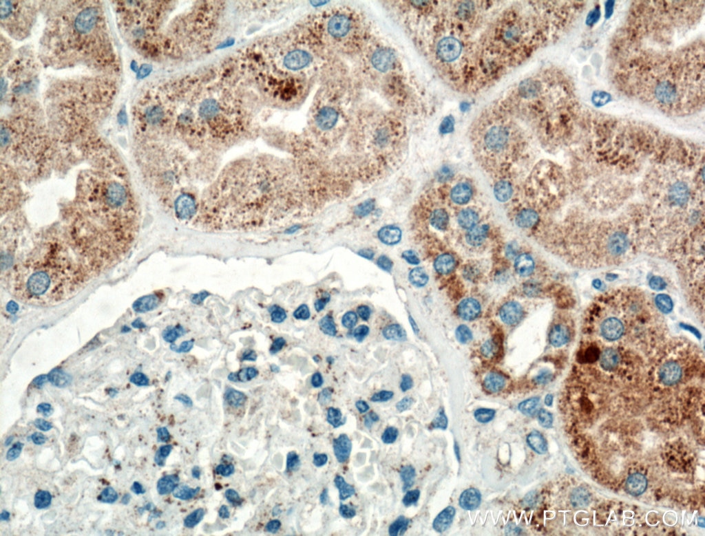 Immunohistochemistry (IHC) staining of human kidney tissue using TIMP-2 Polyclonal antibody (17353-1-AP)