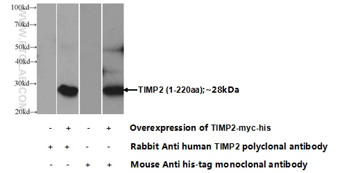 TIMP-2 Polyclonal antibody