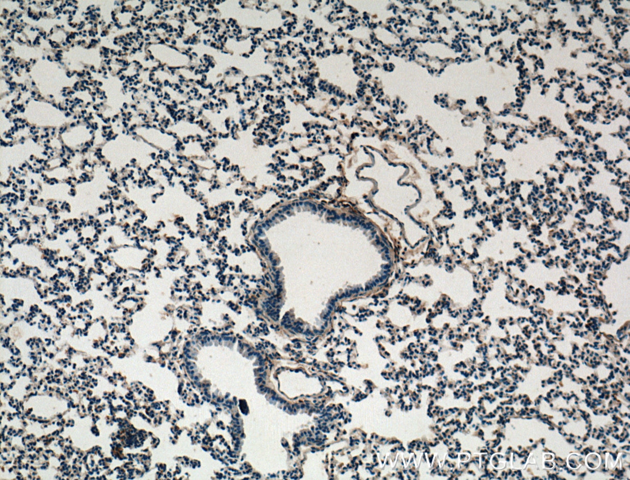 Immunohistochemistry (IHC) staining of mouse lung tissue using TIMP2 Polyclonal antibody (26647-1-AP)