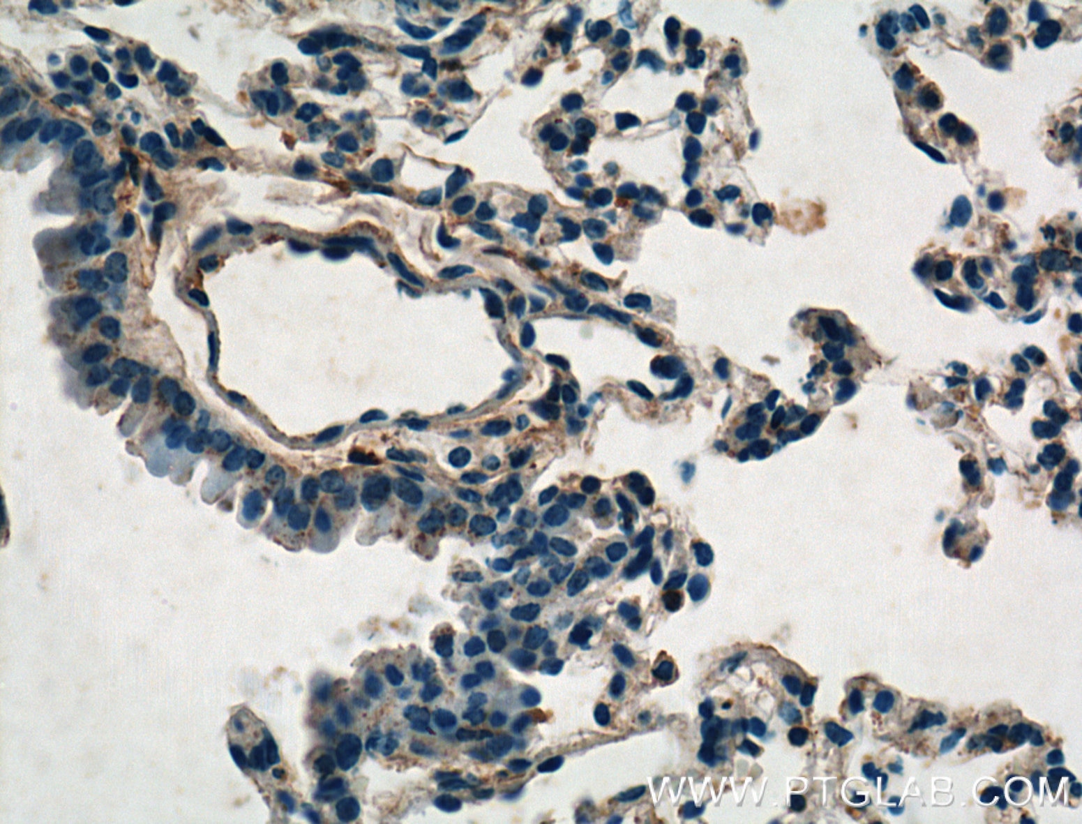 Immunohistochemistry (IHC) staining of mouse lung tissue using TIMP2 Polyclonal antibody (26647-1-AP)