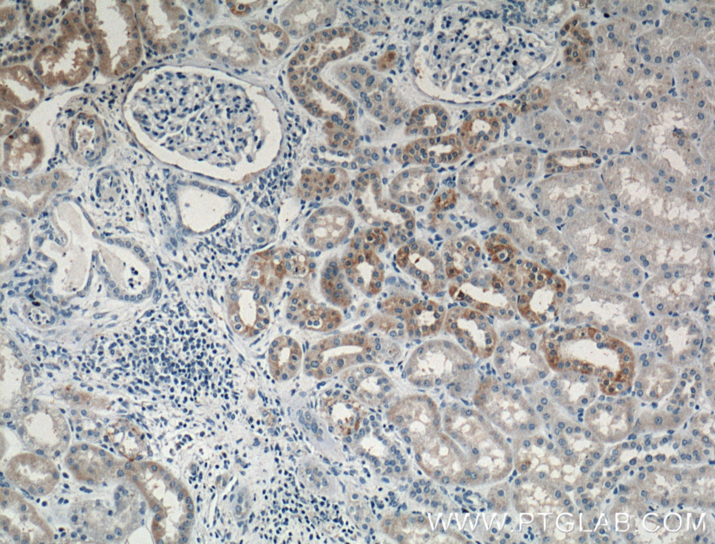Immunohistochemistry (IHC) staining of human kidney tissue using TIMP2 Polyclonal antibody (26647-1-AP)