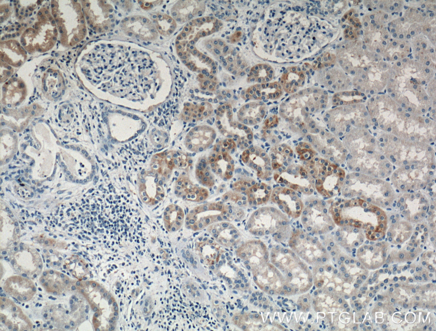 Immunohistochemistry (IHC) staining of human kidney tissue using TIMP2 Polyclonal antibody (26647-1-AP)