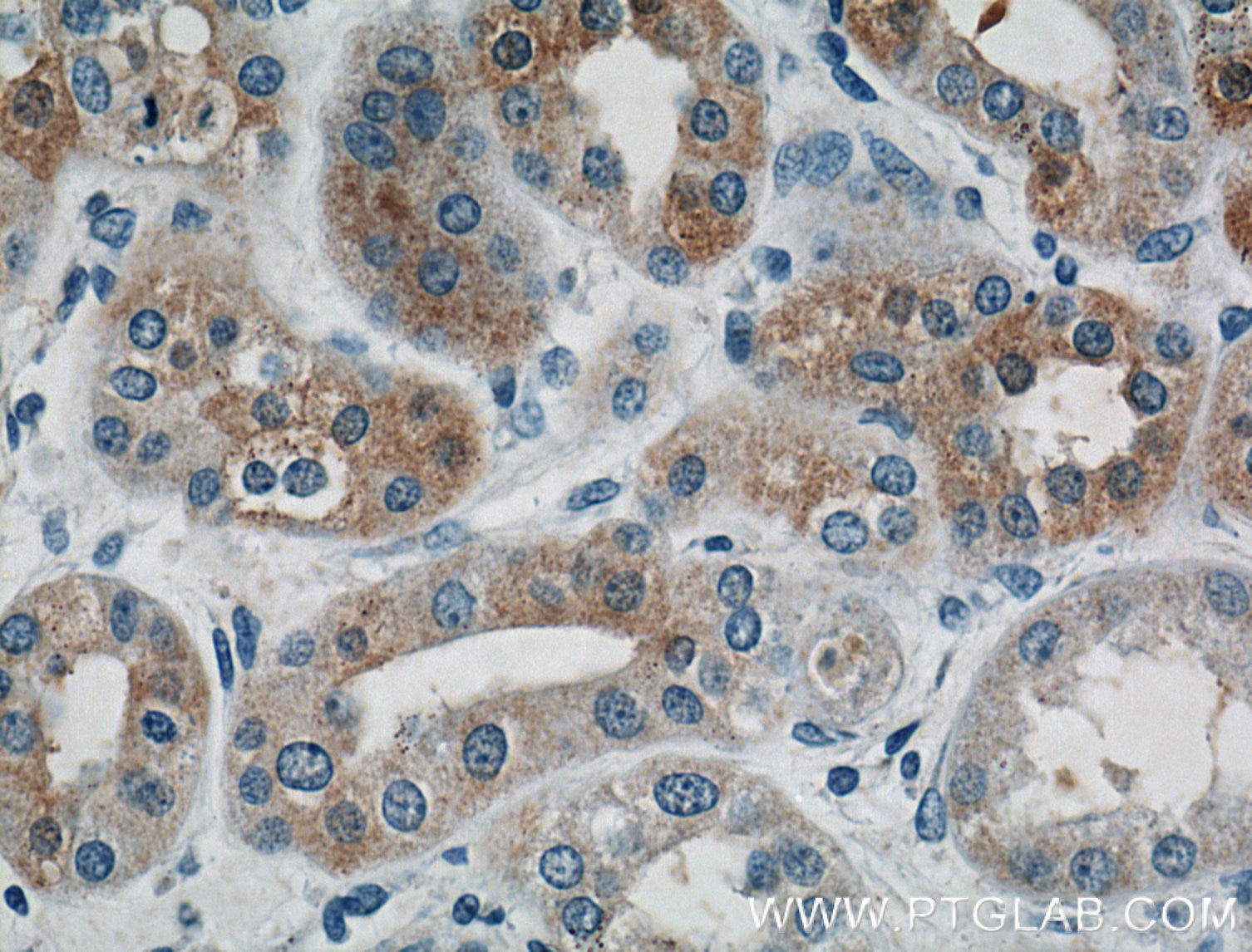 Immunohistochemistry (IHC) staining of human kidney tissue using TIMP2 Polyclonal antibody (26647-1-AP)