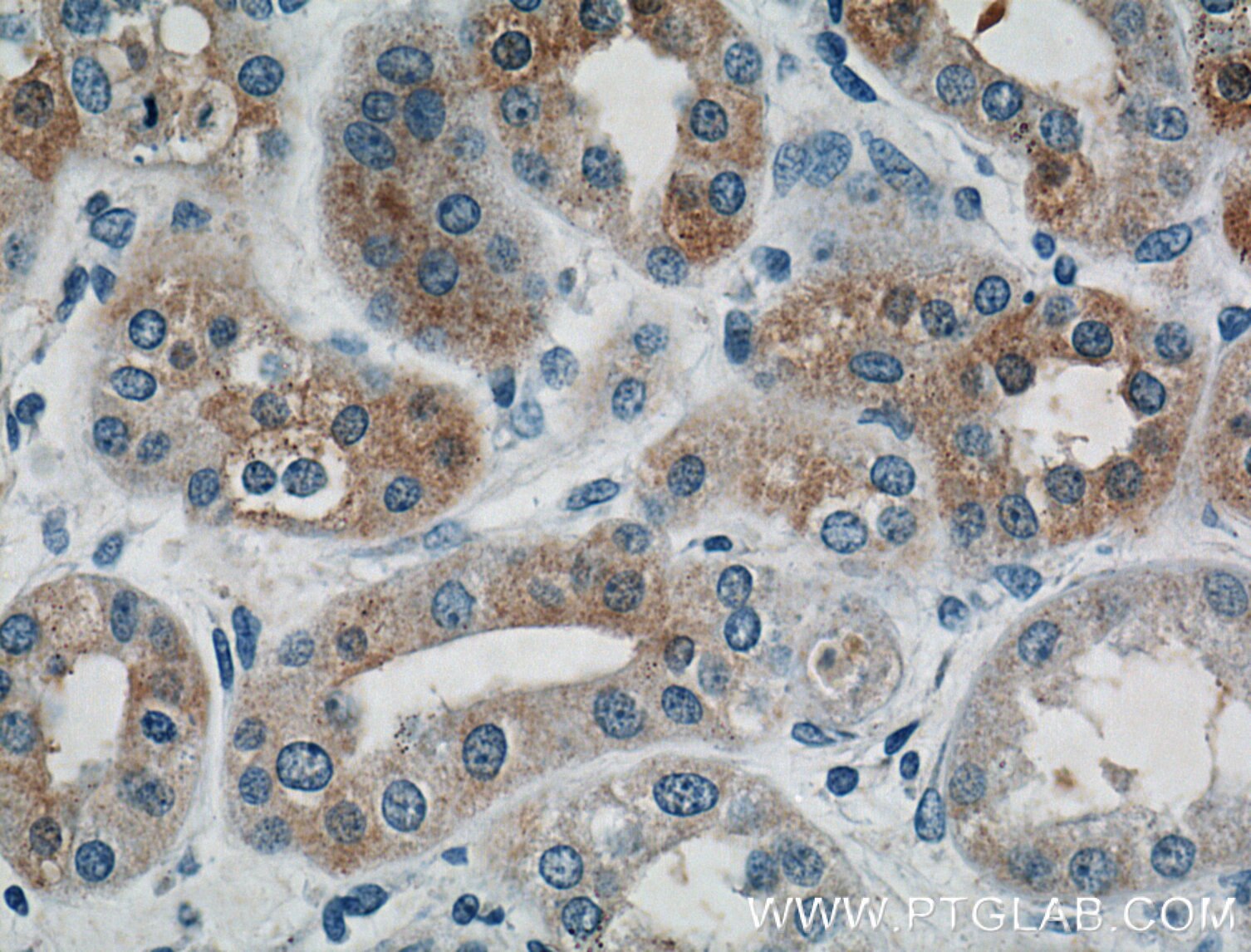 IHC staining of human kidney using 26647-1-AP