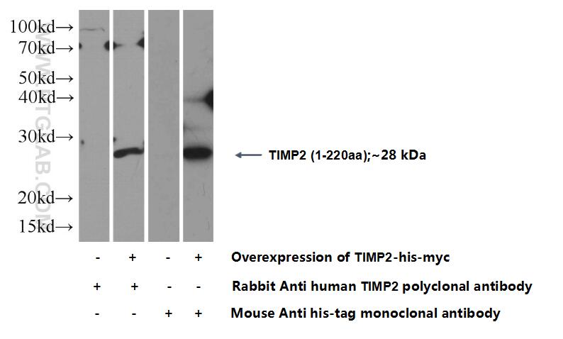 TIMP2 Polyclonal antibody