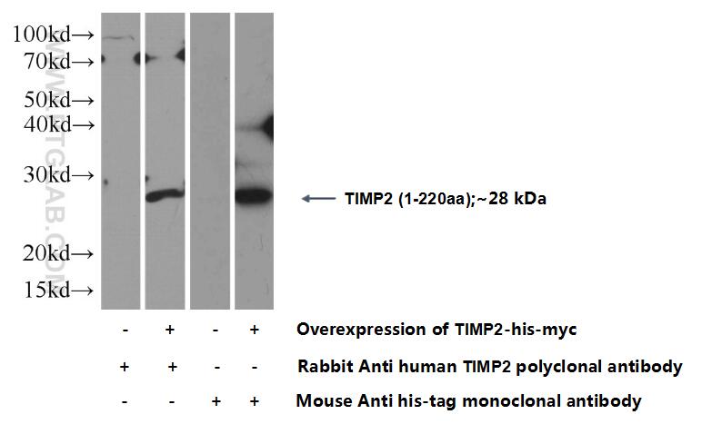 TIMP2