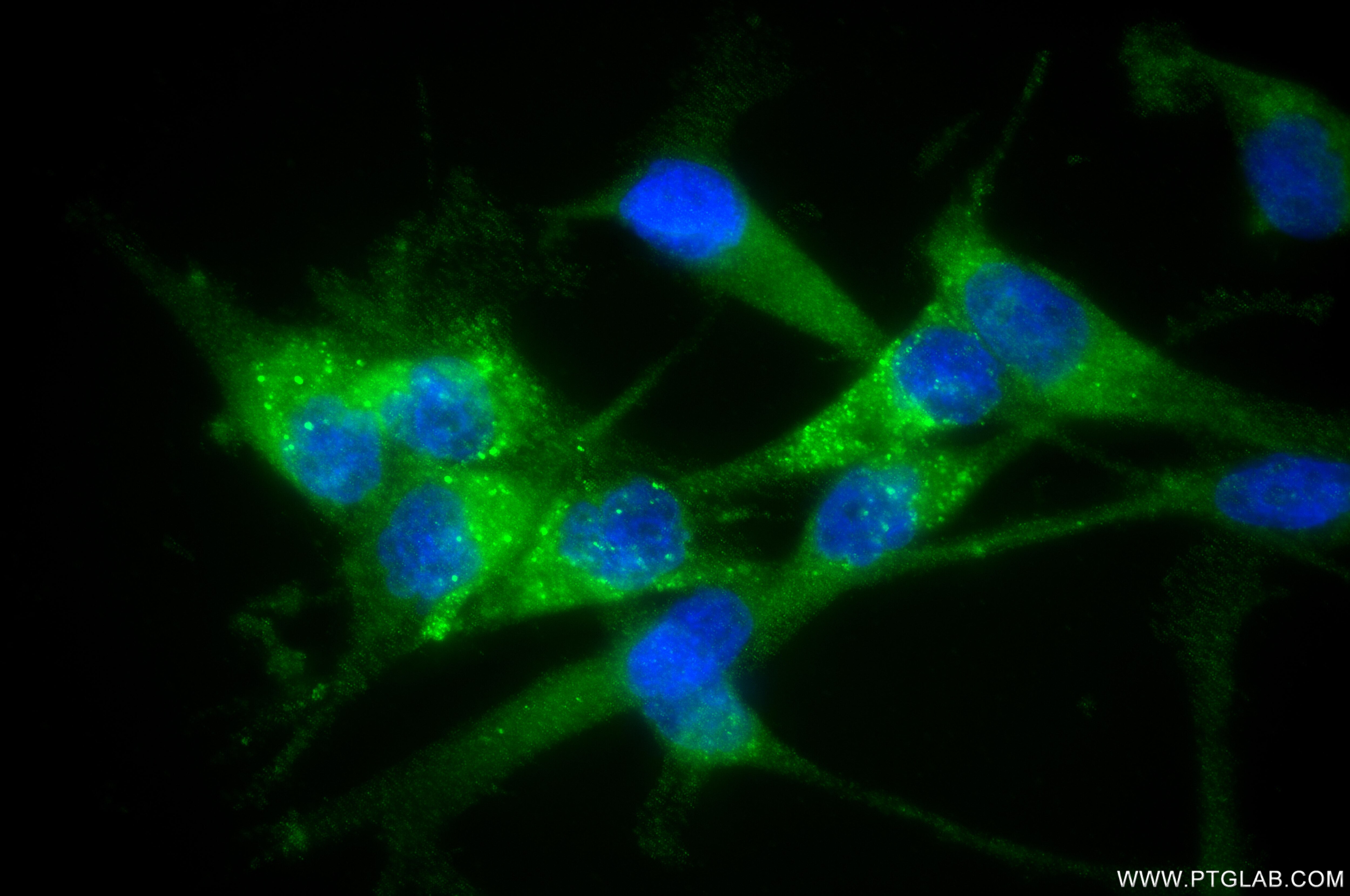 Immunofluorescent analysis of (4% PFA) fixed A172 cells using TIMP2 antibody (85882-2-RR, Clone: 250231B8 ) at dilution of 1:400 and CoraLite®488-Conjugated Goat Anti-Rabbit IgG(H+L) (SA00013-2). Immunofluorescence (IF) / fluorescent staining of A172 cells using TIMP2 Recombinant monoclonal antibody (85882-2-RR)