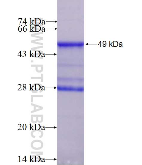 TIMP2 fusion protein Ag10413 SDS-PAGE