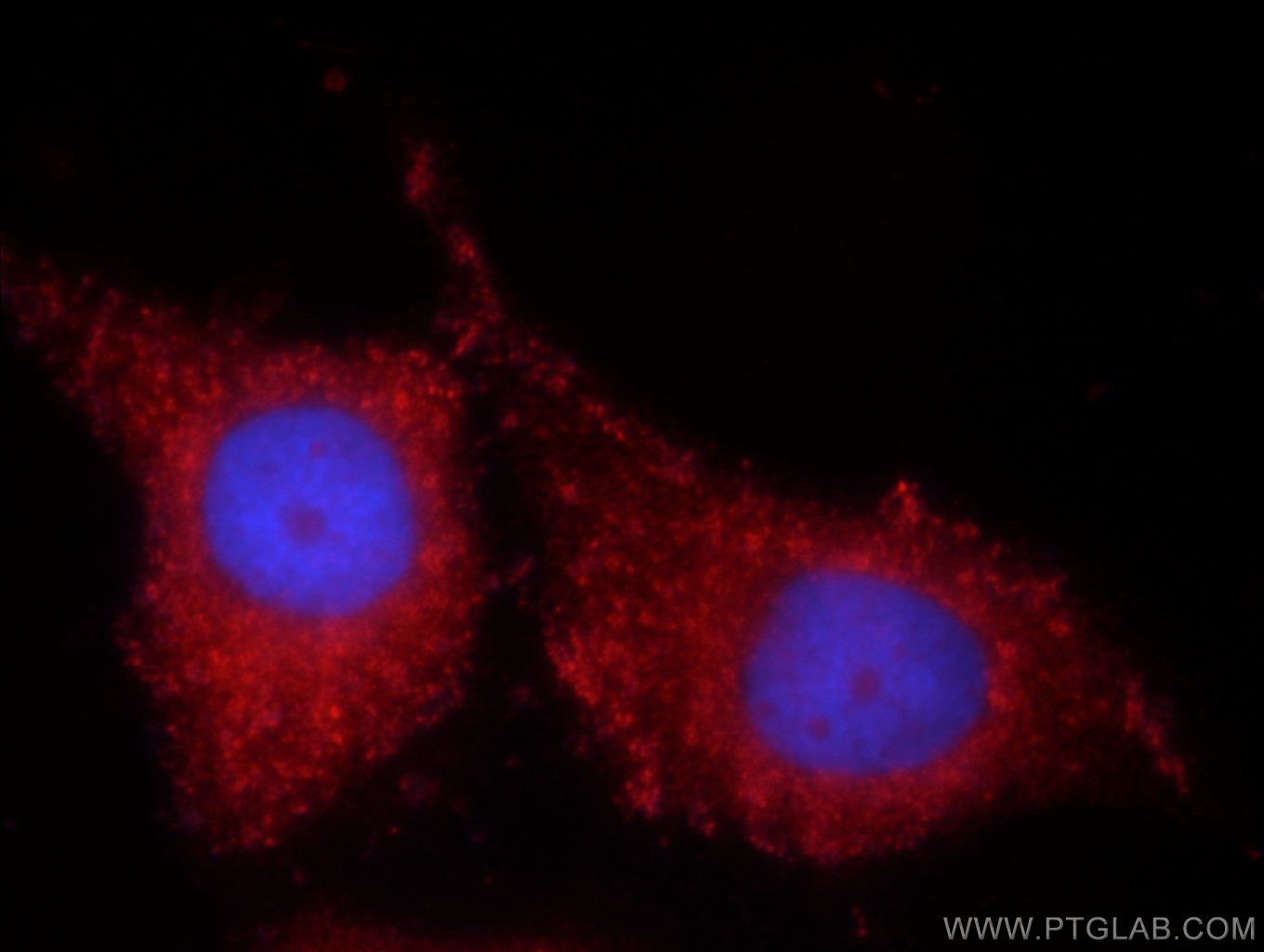 Immunofluorescence (IF) / fluorescent staining of MCF-7 cells using TIMP-4 Polyclonal antibody (12326-1-AP)