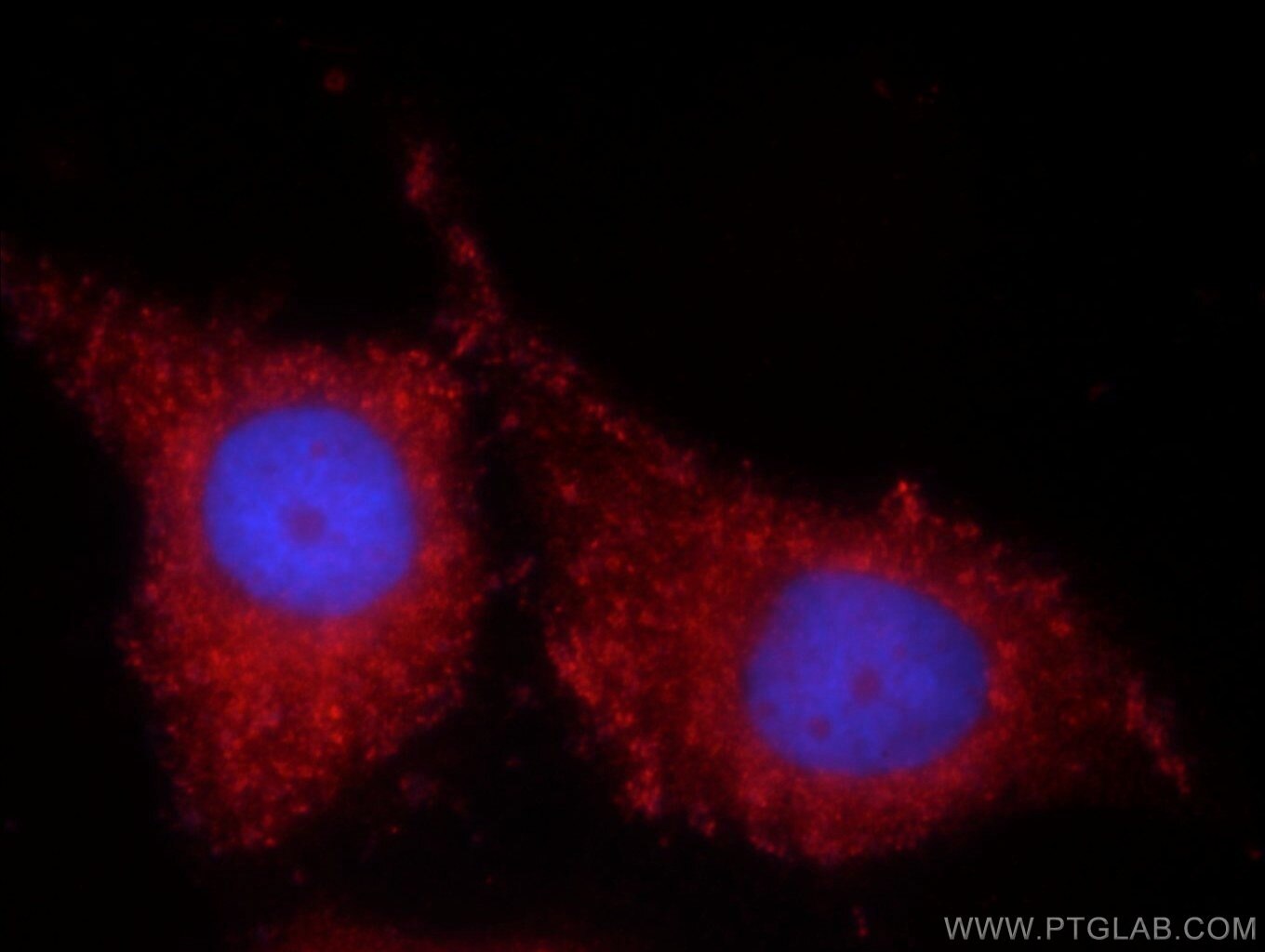 IF Staining of MCF-7 using 12326-1-AP