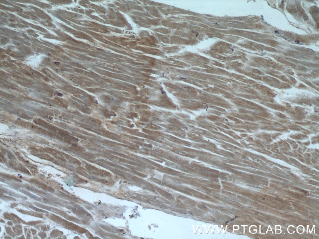 IHC staining of human heart using 12326-1-AP
