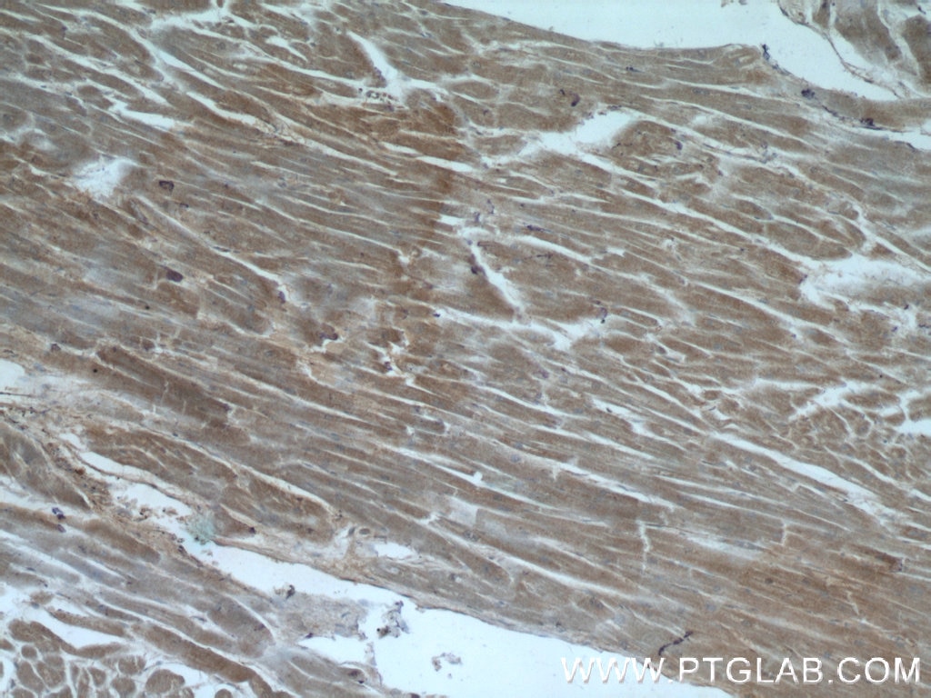 Immunohistochemistry (IHC) staining of human heart tissue using TIMP-4 Polyclonal antibody (12326-1-AP)