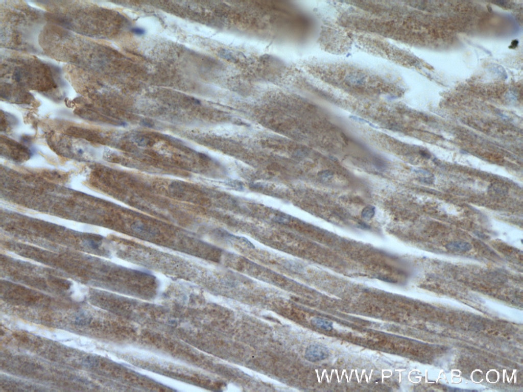 IHC staining of human heart using 12326-1-AP