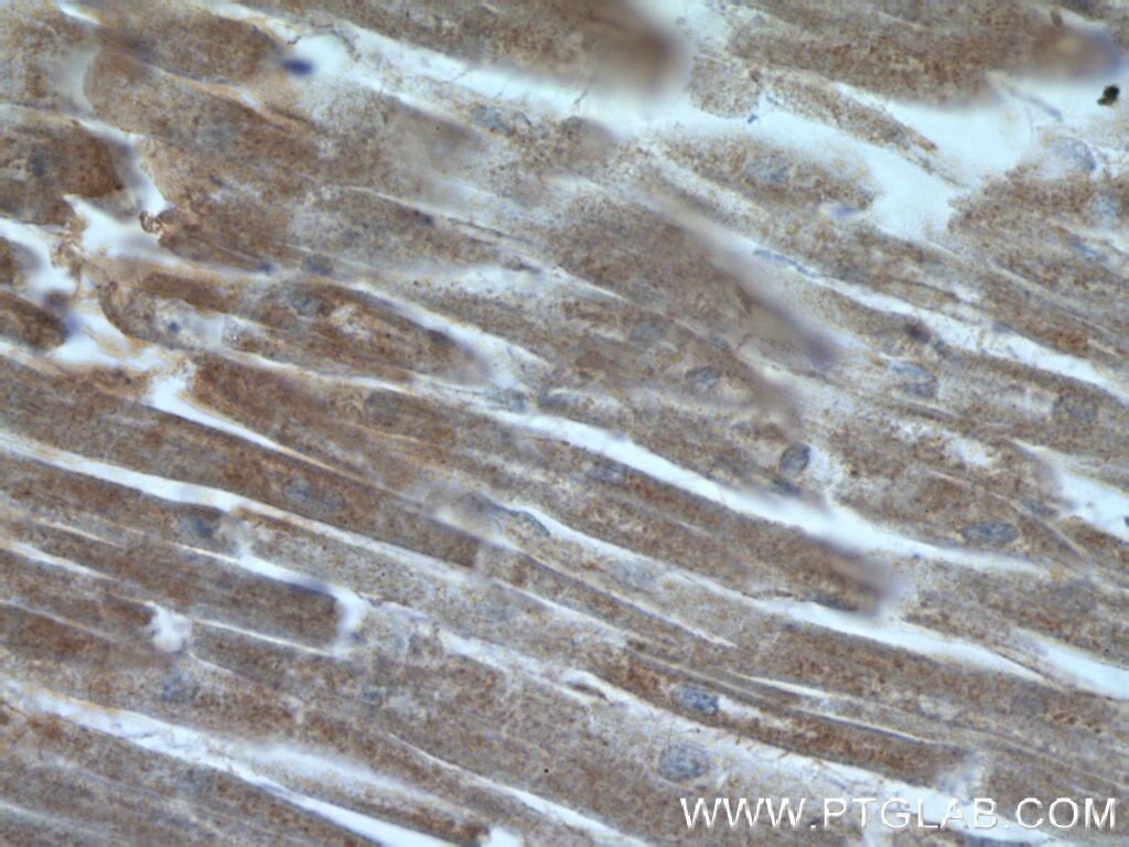 Immunohistochemistry (IHC) staining of human heart tissue using TIMP-4 Polyclonal antibody (12326-1-AP)