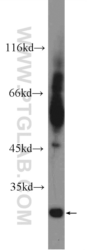 Western Blot (WB) analysis of fetal human brain tissue using TIMP-4 Polyclonal antibody (12326-1-AP)