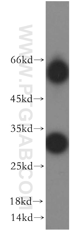 Western Blot (WB) analysis of HT-1080 cells using TIMP-4 Polyclonal antibody (12326-1-AP)