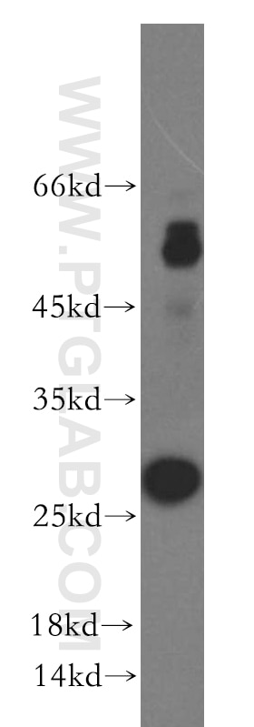 Western Blot (WB) analysis of BxPC-3 cells using TIMP-4 Polyclonal antibody (12326-1-AP)
