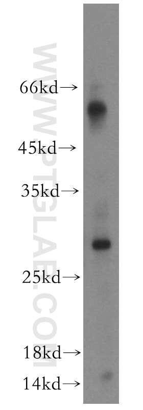 Western Blot (WB) analysis of human heart tissue using TIMP-4 Polyclonal antibody (12326-1-AP)