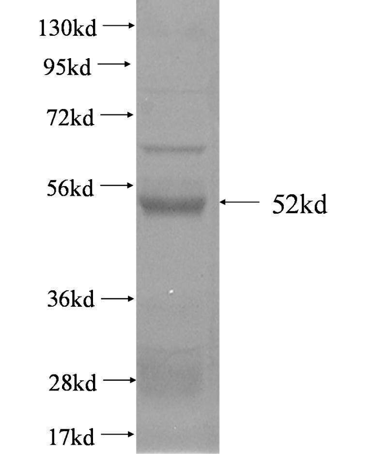TIMP4 fusion protein Ag2927 SDS-PAGE