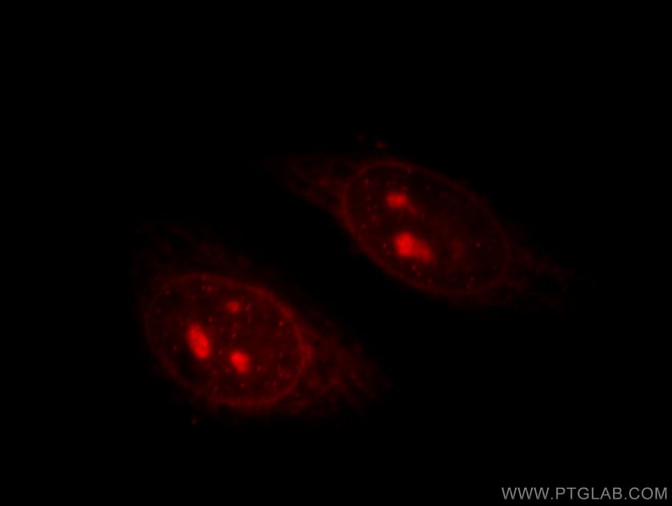 Immunofluorescence (IF) / fluorescent staining of HepG2 cells using TIN2 Polyclonal antibody (11368-1-AP)