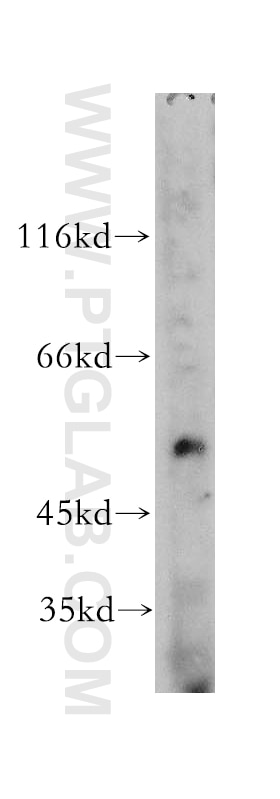 Western Blot (WB) analysis of mouse spleen tissue using TIN2 Polyclonal antibody (11368-1-AP)