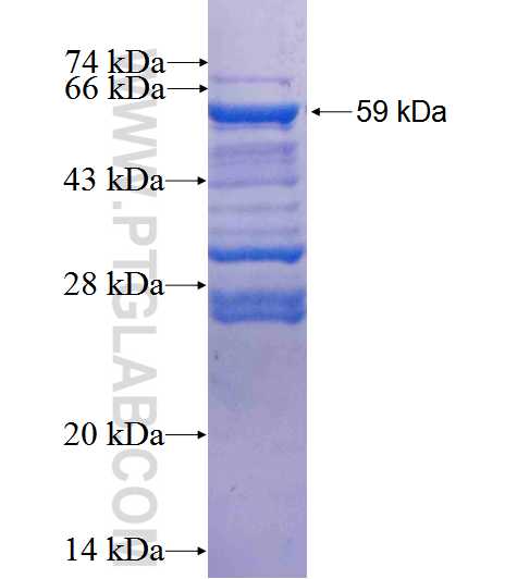 TIN2 fusion protein Ag1922 SDS-PAGE