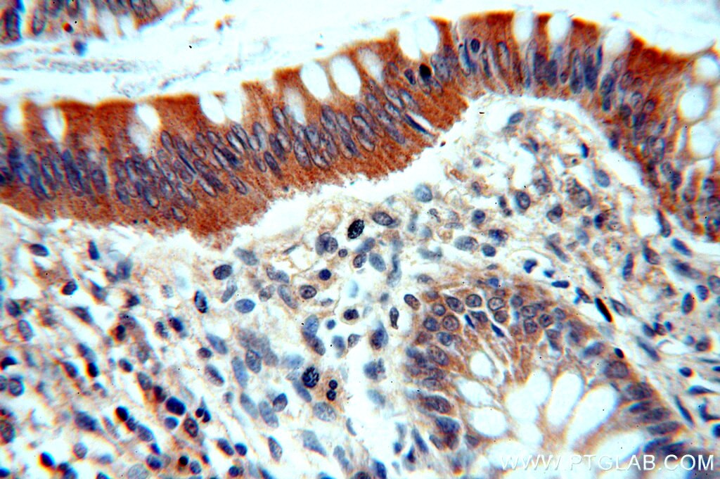 Immunohistochemistry (IHC) staining of human colon tissue using TINAG-Specific Polyclonal antibody (19747-1-AP)