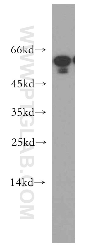 Western Blot (WB) analysis of mouse small intestine tissue using TINAG-Specific Polyclonal antibody (19747-1-AP)