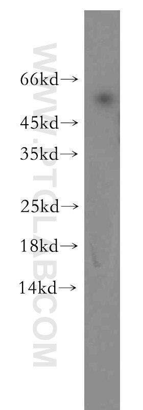 Western Blot (WB) analysis of human kidney tissue using TINAG-Specific Polyclonal antibody (19747-1-AP)