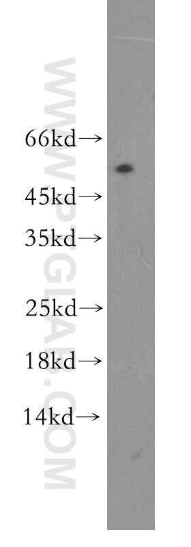 Western Blot (WB) analysis of human placenta tissue using TINAG-Specific Polyclonal antibody (19747-1-AP)