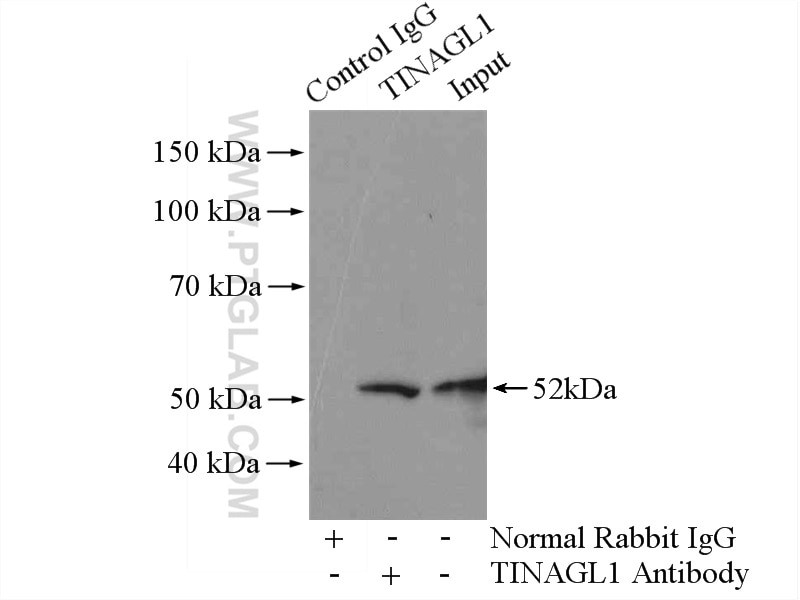 Immunoprecipitation (IP) experiment of mouse heart tissue using TINAGL1 Polyclonal antibody (12077-1-AP)