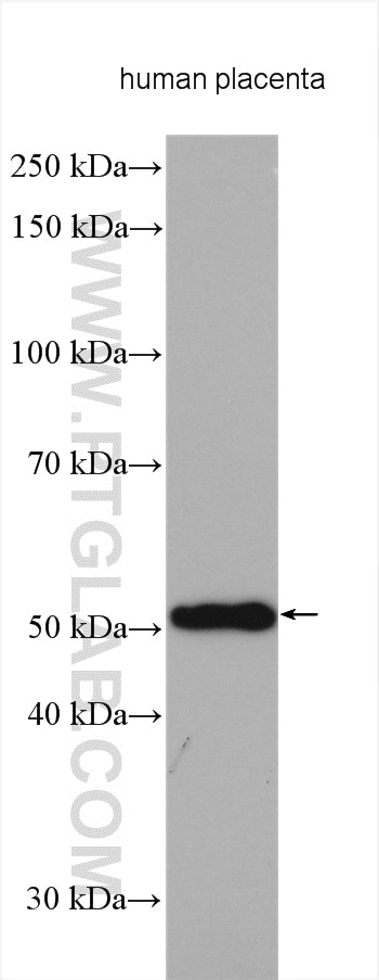 Western Blot (WB) analysis of various lysates using TINAGL1 Polyclonal antibody (12077-1-AP)