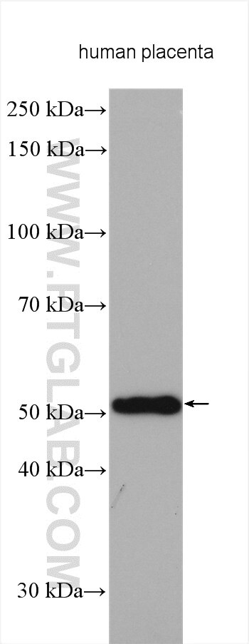 Western Blot (WB) analysis of various lysates using TINAGL1 Polyclonal antibody (12077-1-AP)