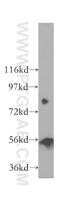 Western Blot (WB) analysis of human adrenal gland tissue using TINAGL1 Polyclonal antibody (12077-1-AP)