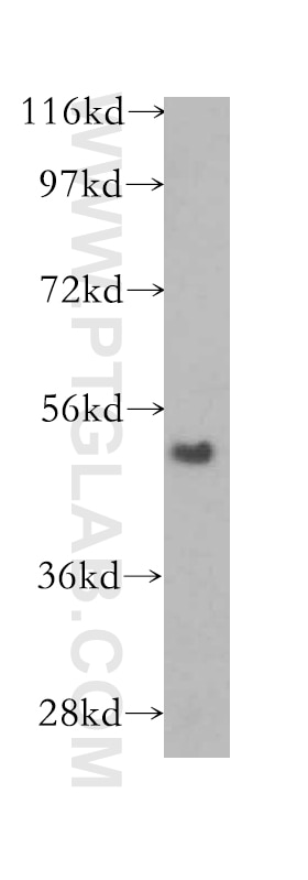 Western Blot (WB) analysis of human placenta tissue using TINAGL1 Polyclonal antibody (12077-1-AP)