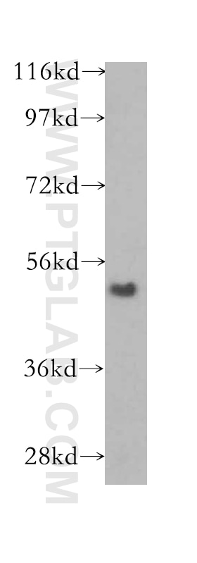 WB analysis of human placenta using 12077-1-AP