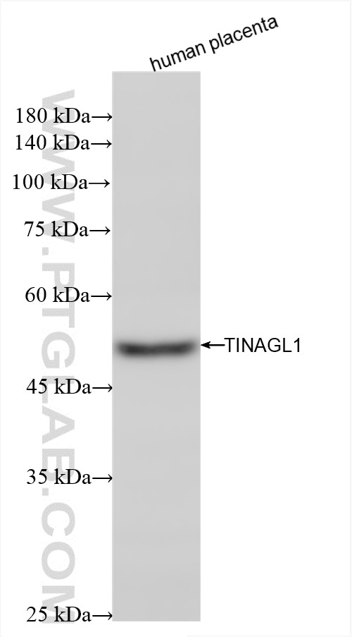 Western Blot (WB) analysis of various lysates using TINAGL1 Recombinant antibody (85140-2-RR)