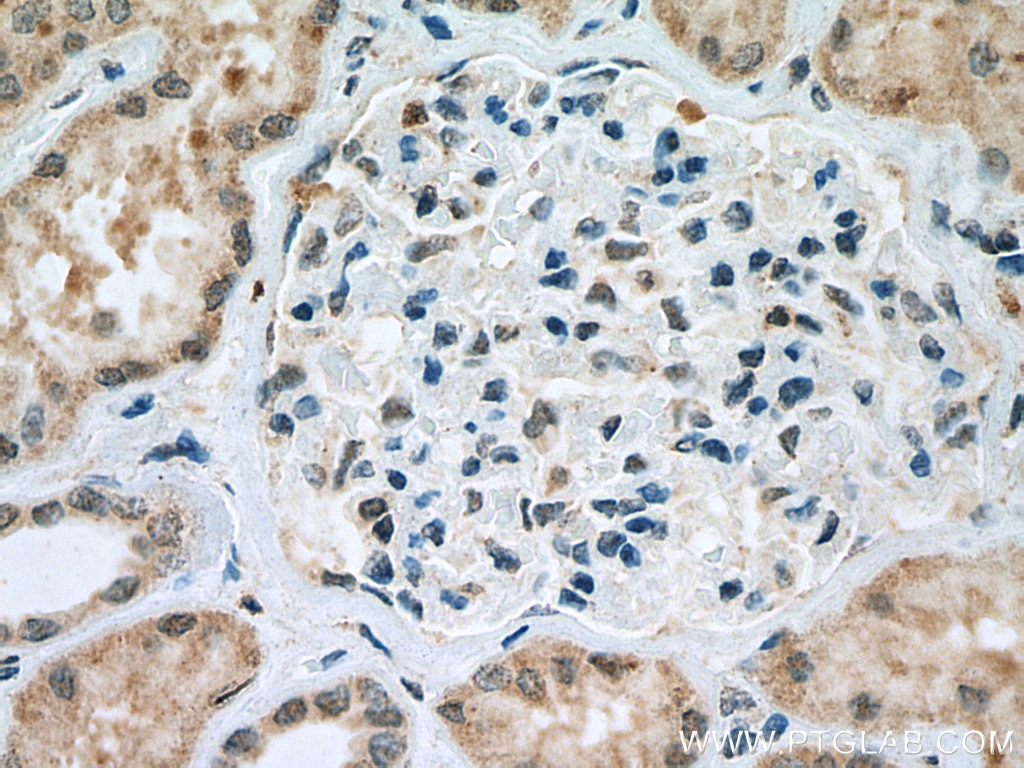 Immunohistochemistry (IHC) staining of human kidney tissue using TINP1 Polyclonal antibody (16230-1-AP)