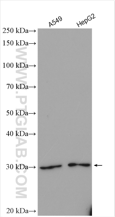 Western Blot (WB) analysis of various lysates using TINP1 Polyclonal antibody (16230-1-AP)