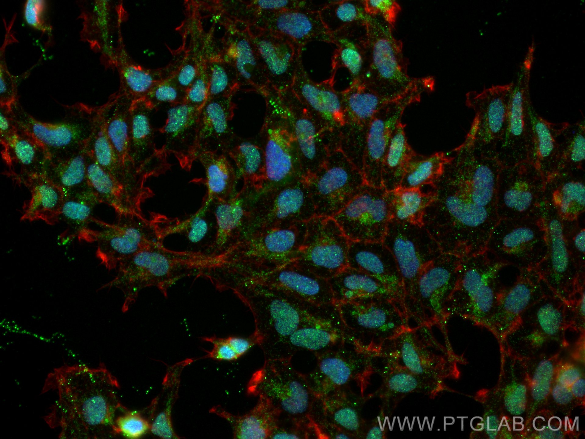 Immunofluorescence (IF) / fluorescent staining of HEK-293 cells using TINP1 Monoclonal antibody (66374-1-Ig)
