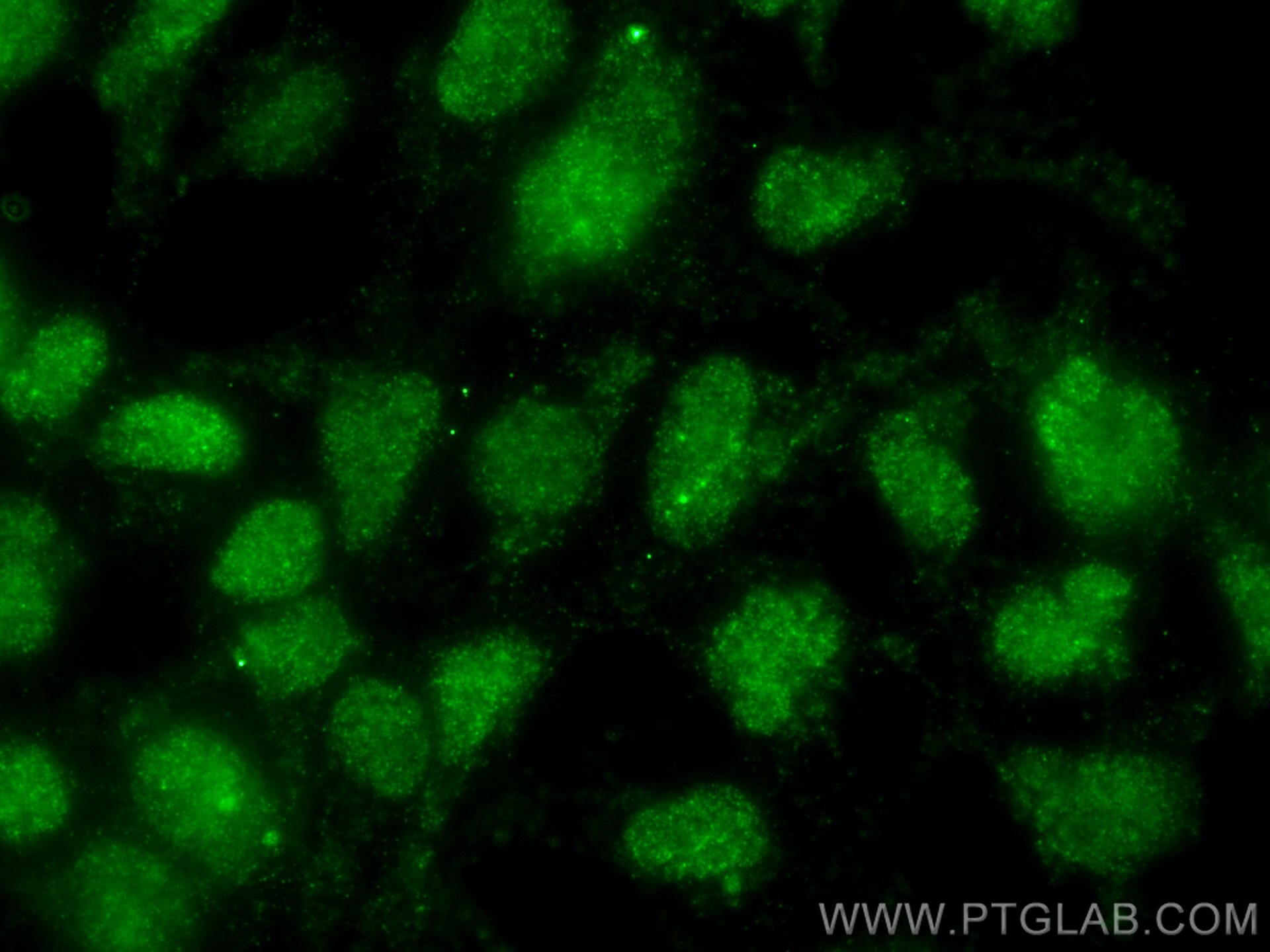 Immunofluorescence (IF) / fluorescent staining of HEK-293 cells using TINP1 Monoclonal antibody (66374-1-Ig)