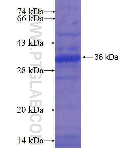 TINP1 fusion protein Ag8822 SDS-PAGE
