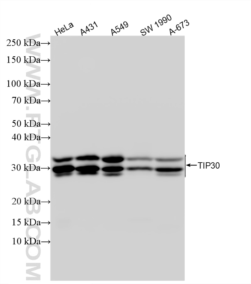 Western Blot (WB) analysis of various lysates using TIP30 Recombinant monoclonal antibody (86972-1-RR)