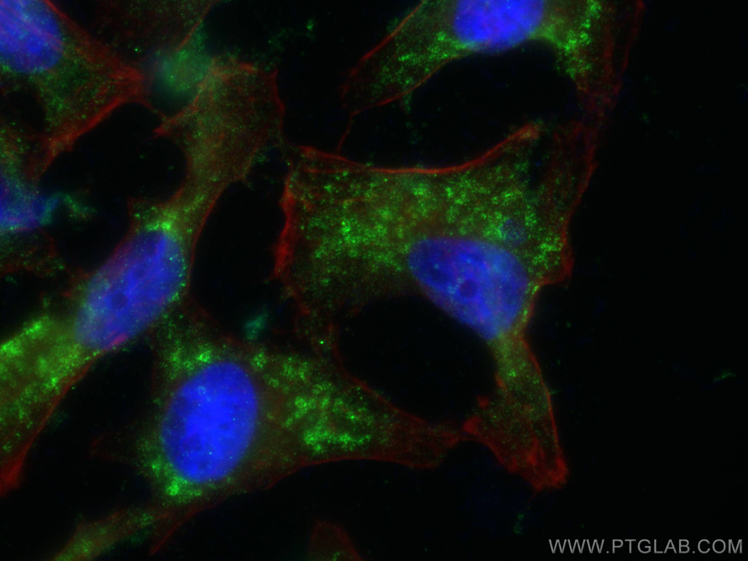 Immunofluorescence (IF) / fluorescent staining of HeLa cells using TIP47 Monoclonal antibody (66523-1-Ig)